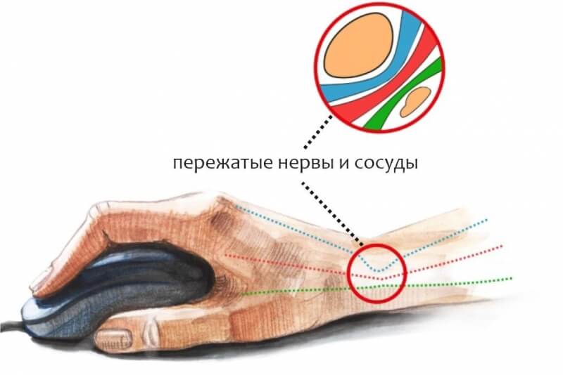 Кракен вывод средств